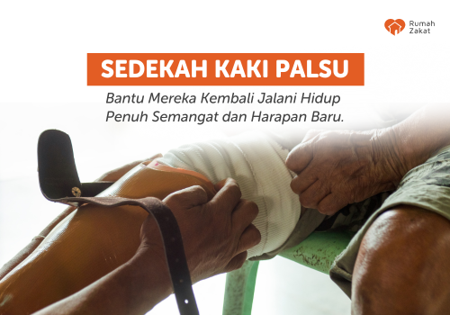 Sedekah Kaki Palsu
